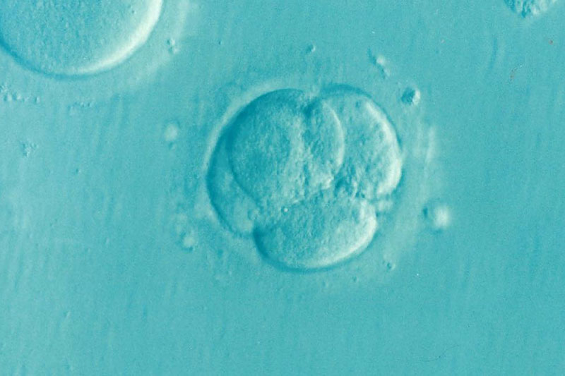 Read more about the article Frozen Embryo Transfer (FET)